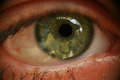 Eye II